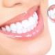 Важно знать: процедура отбеливания зубов